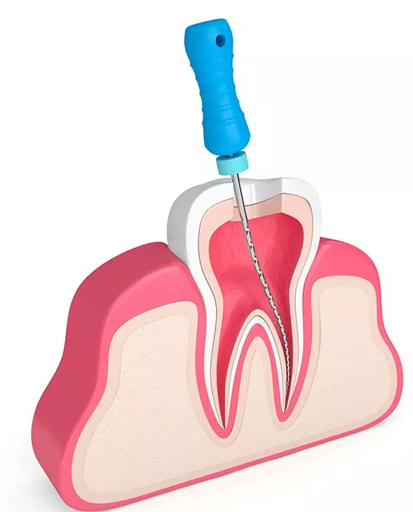 Diagram showing inside of tooth.